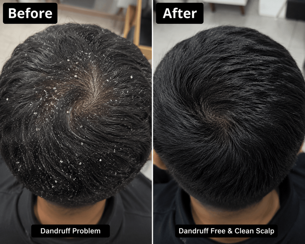 4 in 1 Hair Oil