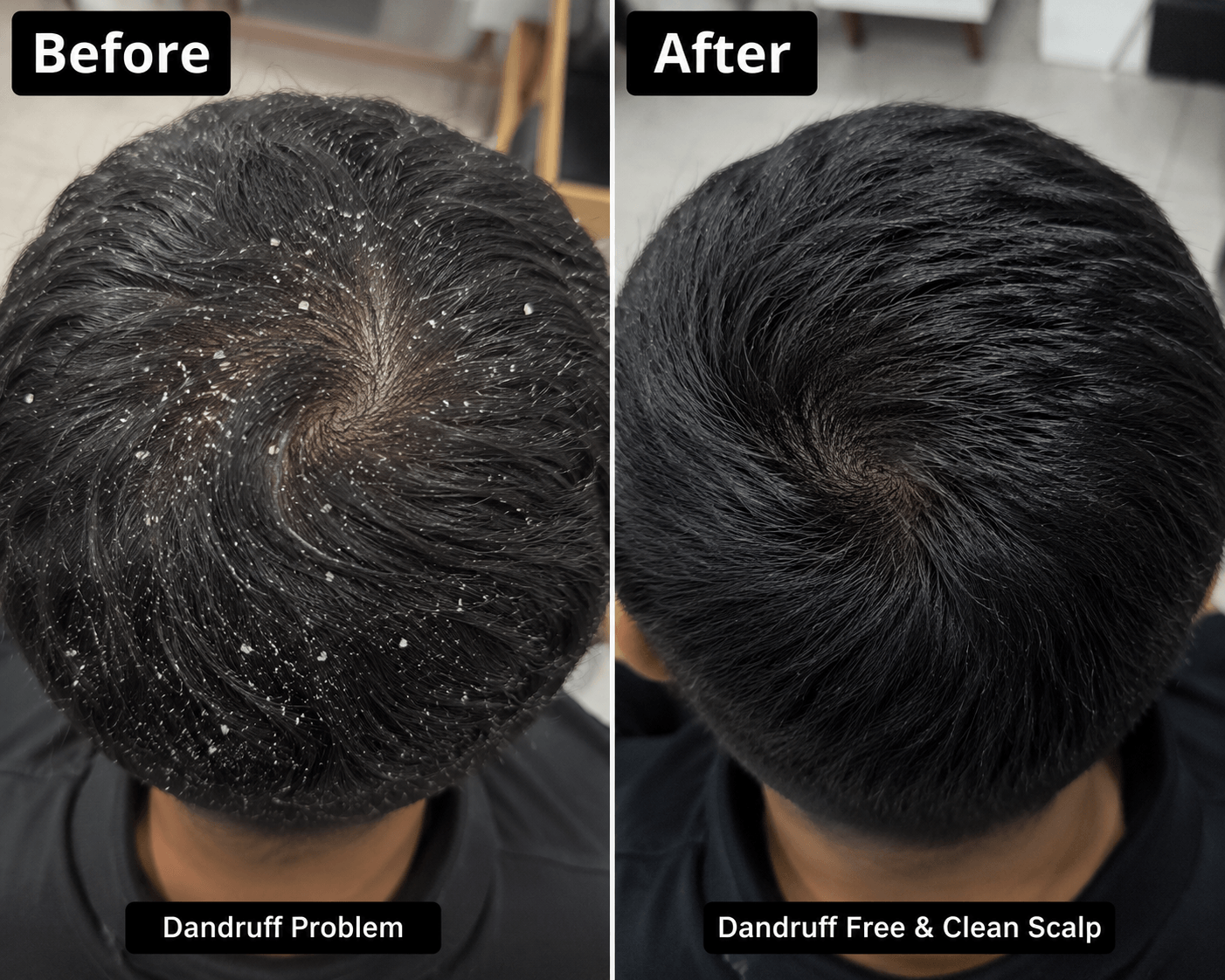4 in 1 Hair Oil