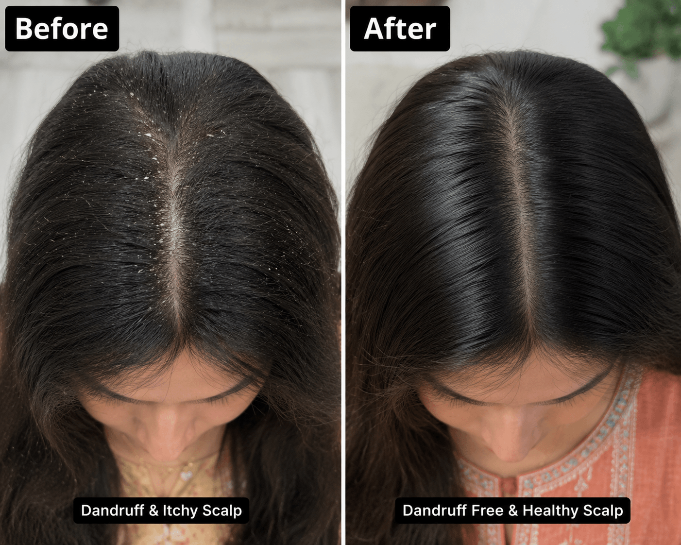 Onion Hair Growth Oil
